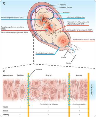 Understanding Host-Pathogen Interactions in Acute Chorioamnionitis Through the Use of Animal Models